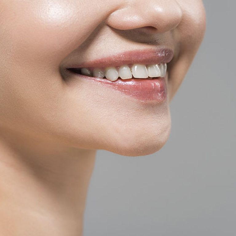 uniquedent_web_services_0020_cropped-view-of-cheerful-woman-smiling-isolated-on-2026-03-11-03-25-06-utc